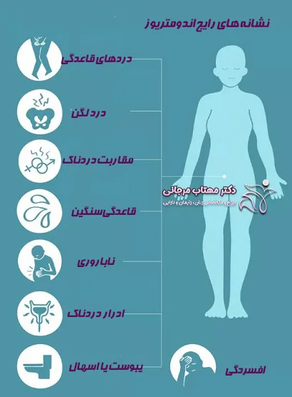 علائم آندومتریوز