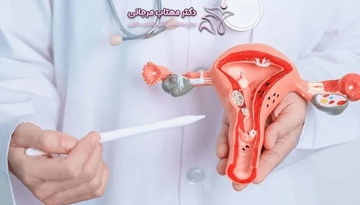 عمل سرکلاژ چه زمانی انجام می شود؟
