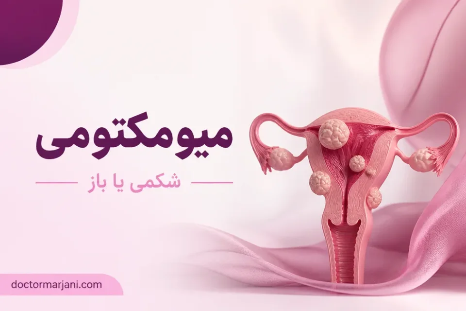 میومکتومی شکمی یا باز — مقایسه مسیرهای هیستروسکوپیک، لاپاراسکوپیک و باز در میومکتومی