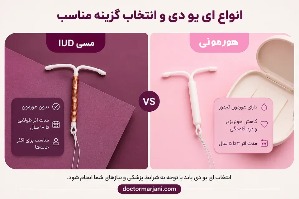 IUD